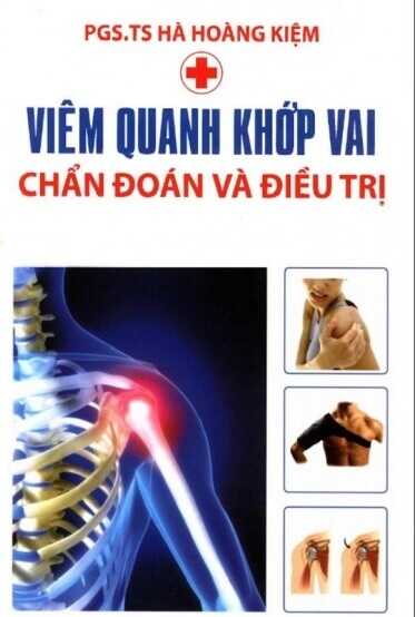 Viêm Quanh Khớp Vai Chẩn Đoán Và Điều Trị