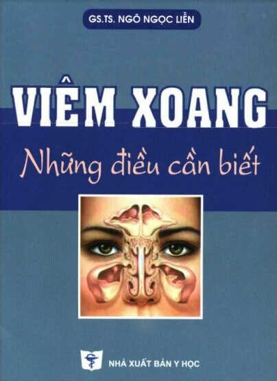 Viêm Xoang Những Điều Cần Biết