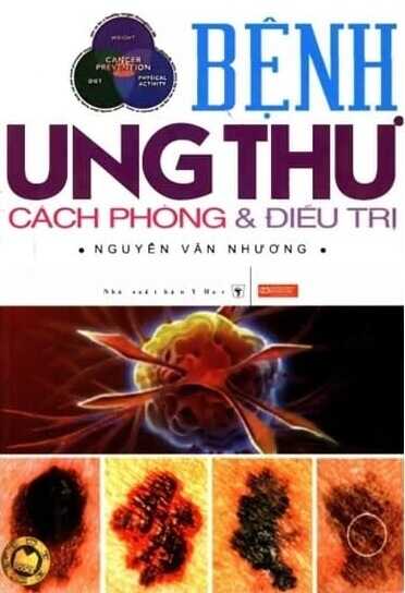 Bệnh Ung Thư Cách Phòng Và Điều Trị