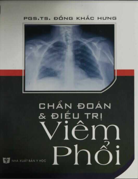 Chẩn Đoán Và Điều Trị Viêm Phổi
