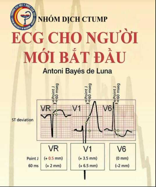 ECG Cho Người Mới Bắt Đầu – Ecgs For Beginners